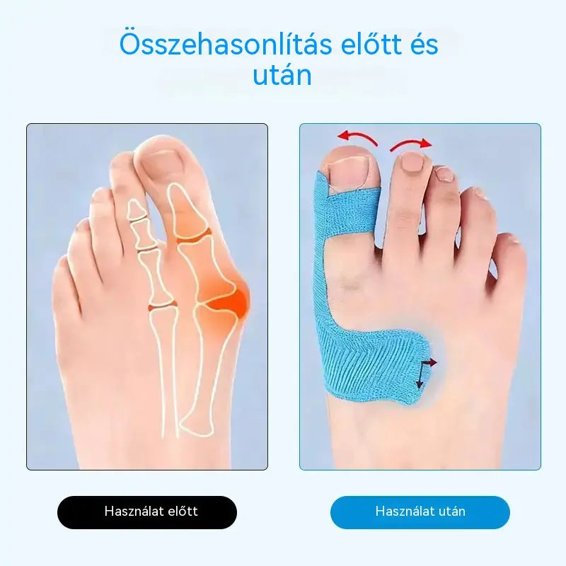 [50/100 darab] Rugalmas ujjvédők, égési sérülésekre való tapaszok, tartós sportkötések